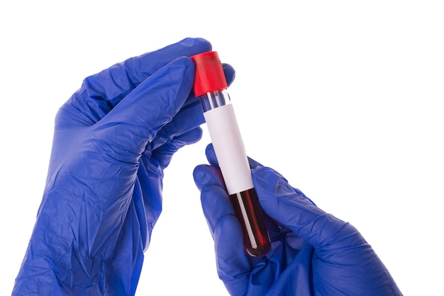 Closeup photo of hands in blue protective latex gloves opening test tube with red liquid isolated over white color background