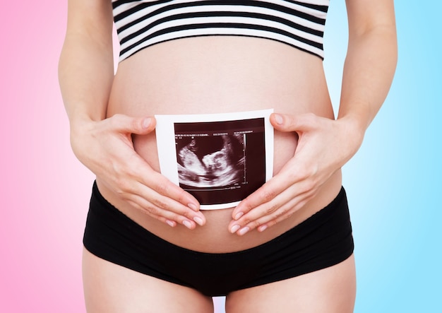 Крупным планом беременная женщина, держащая ультразвуковое изображение