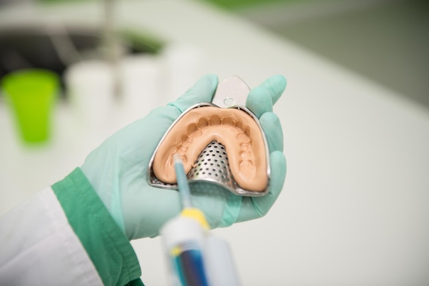 Closeup Shot Of Dental Impression With Implant