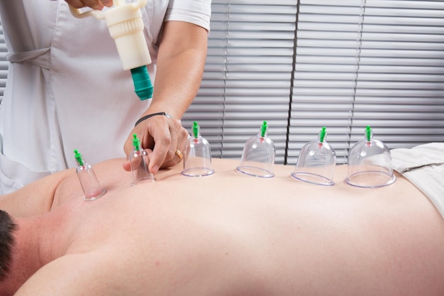 Closeup Of Therapist's Hand Placing Cups On body