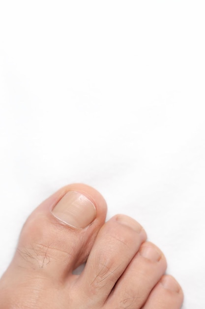 Closeup of a toe with white background and space above for text