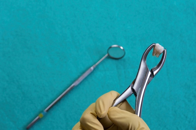 Closeup of a tooth extraction with forceps on a blue surface