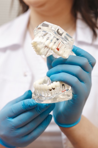 Closeup view of jaw model in dentist's hands.