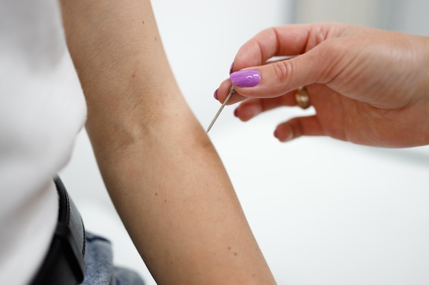 Closeup view of a neurologist doctor checking reflexes on a female patient's hand