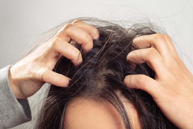 Photo closeup woman hand itchy scalp, hair care concept