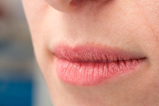 Closeup of a woman with pink chapped lips