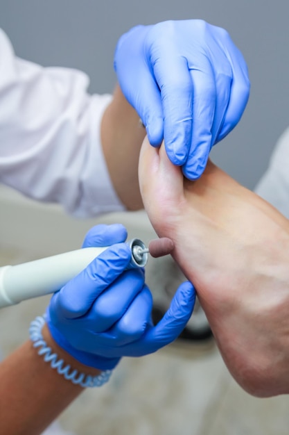 Closeup of a woman working with a special tool on her foot Pedicure The filing of calluses