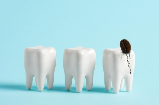 写真 コーヒー豆は人間の白い歯を壊す 歯の問題の最小限のアートポスター 歯の広告