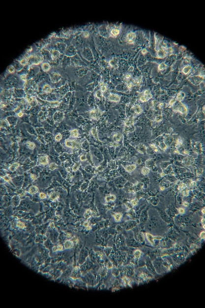 Colony characteristic of bacteria for study in laboratory microbiology