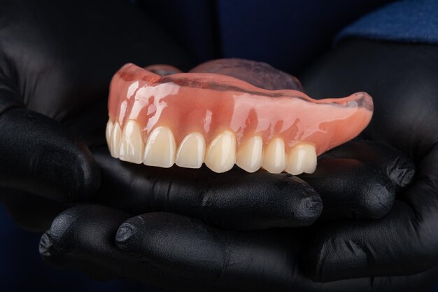 Complete denture on black gloves dentist hand Healthcare dental concept