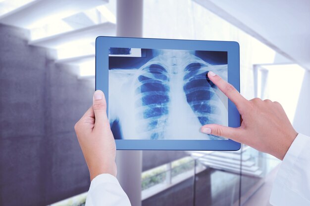 Composite image of doctor looking at xray on tablet