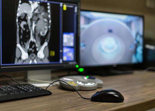 Photo computers at desk in hospital