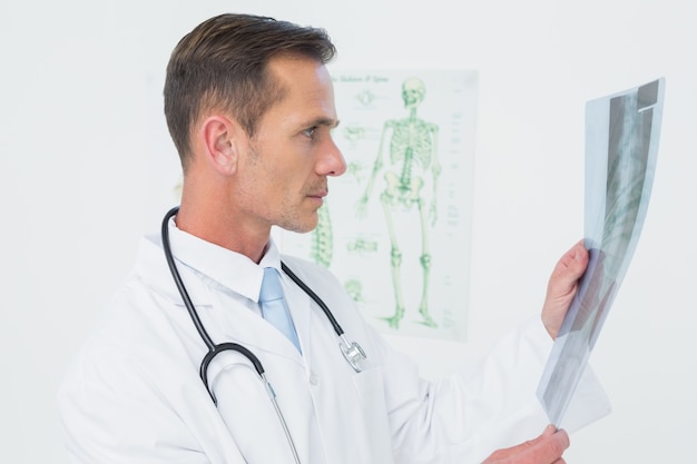 Concentrated male doctor looking at spine xray