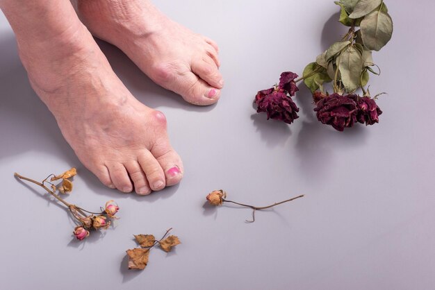 Concept of foot disease in old woman with dry flowers