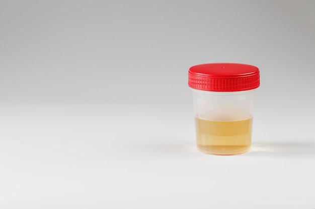 Container with medical urine tests
