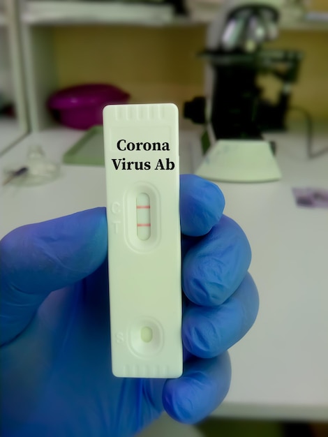 Corona Virus-antilichaamtesten door snelle testcassette