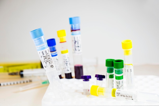 Photo corona virus and covid-19 positive blood test tube blood test samples diagnosis and laboratory