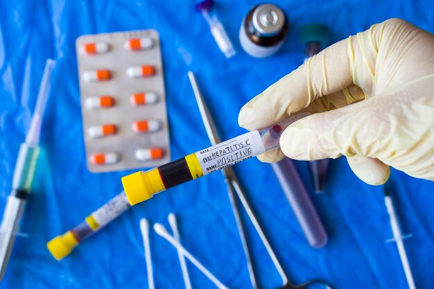 Corona virus negative blood test tubes on the white background studio shoot blood test samples