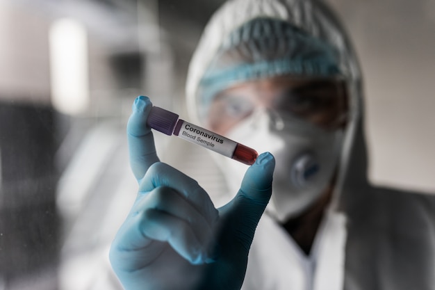 Coronavirus 2019-nCoV Blood Sample. Corona virus outbreaking. Epidemic virus Respiratory Syndrome. Man in protective clothes holding blood test.