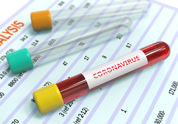 Coronavirus blood samples