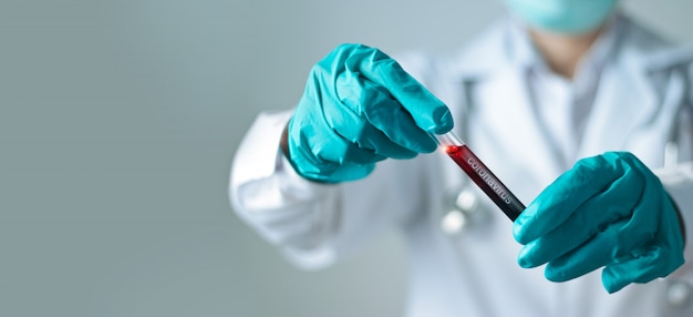 Coronavirus blood test, Doctor holding test glass tube with blood for covid-19 analyzing.