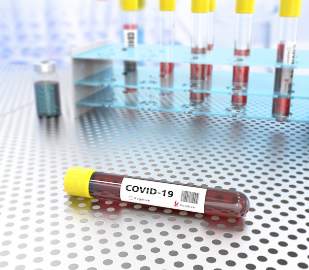 Coronavirus blood test in hospital laboratory