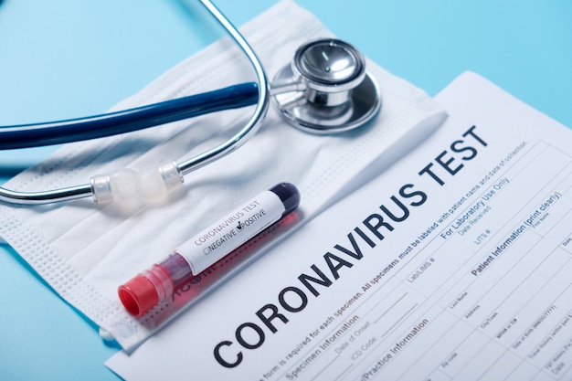 Foto esame del sangue di coronavirus in laboratorio