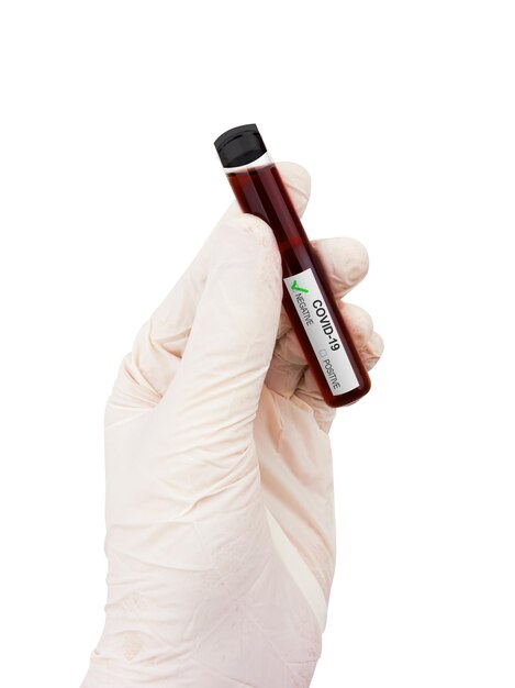 Coronavirus Covid 19 blood sample in sample tube in hand