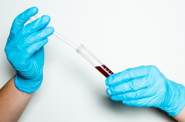 Coronavirus COVID-19 blood test. Hands with test materials. Medical testing procedure