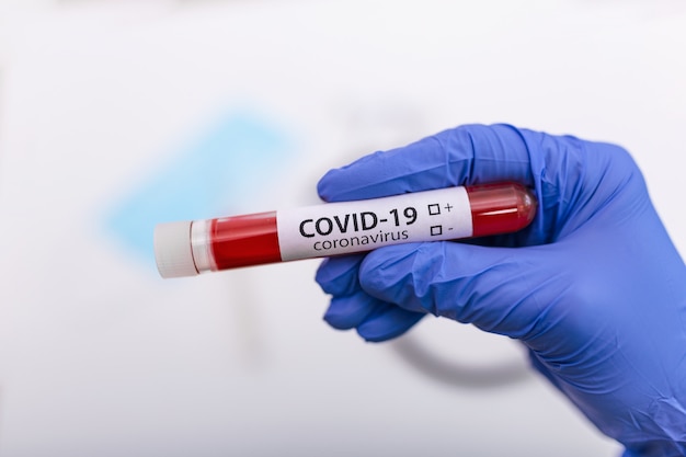 Coronavirus Covid 19 заразил образец крови в пробирке для взятия на руки ученого доктора защитной одежды биологической опасности в Coronavirus Covid 19 научно-исследовательской лаборатории, исследования вакцины Coronavirus Covid-19