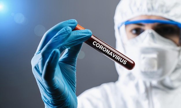 Coronavirus COVID 19 nCov-uitbraak. medische of wetenschappelijke holding Corona Virus Blood Test Tube van patiënt. Positief geval van Korona Virus Europa, Italië, Wuhan, China. Epidemische en pandemische infectie