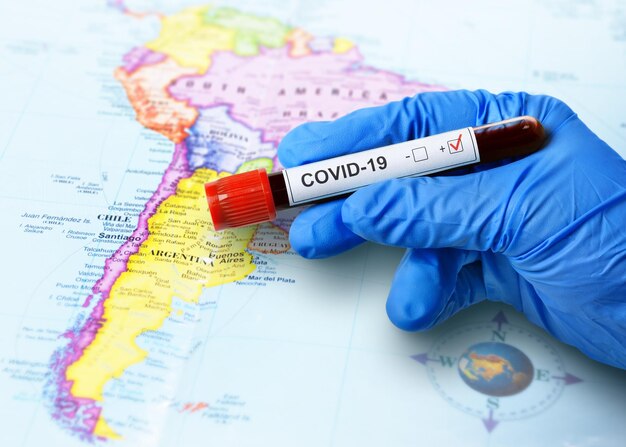 Coronavirus-epidemie in Zuid-Amerika