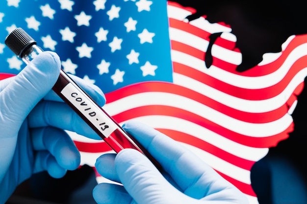 Coronavirus outbreak in USA. Hand in medical gloves holding sample blood in tube over flag of United States of America. Blood test for Covid-19