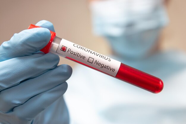 Coronavirus positive blood test Doctor in medical mask and latex gloves holds a test tube with blood