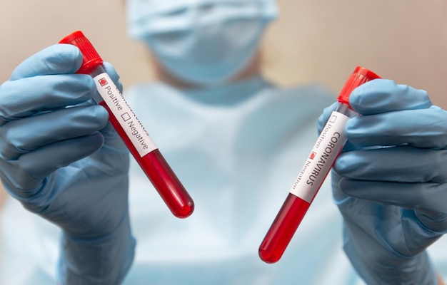 Coronavirus positive and negative blood test test tubes with\
blood