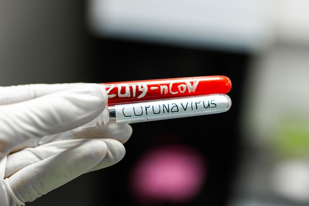 Photo coronavirus study test tubes with vaccine analyzes