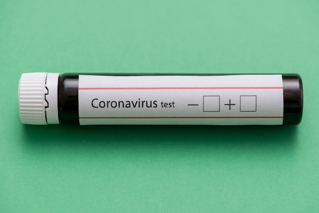 사진 녹색 배경에 코로나 바이러스 테스트