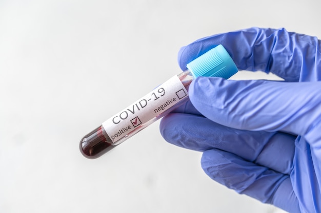 Coronavirus testen
