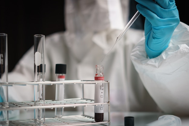 Coronavirus testing process, a hand holds tube drop chemical solution
 in  blood test samples.