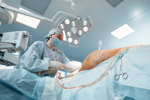Chirurgia estetica della liposuzione nell'ambiente della sala operatoria reale che mostra il gruppo di chirurghi durante l'operazione.