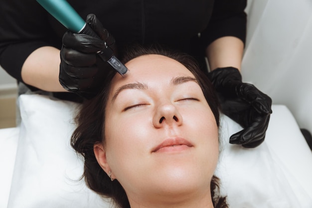 Cosmetic mesotherapy for facial rejuvenation Cosmetic procedure of microneedling The cosmetologist injects hyaluronic acid into the face of the girl's patient with the help of dermopen