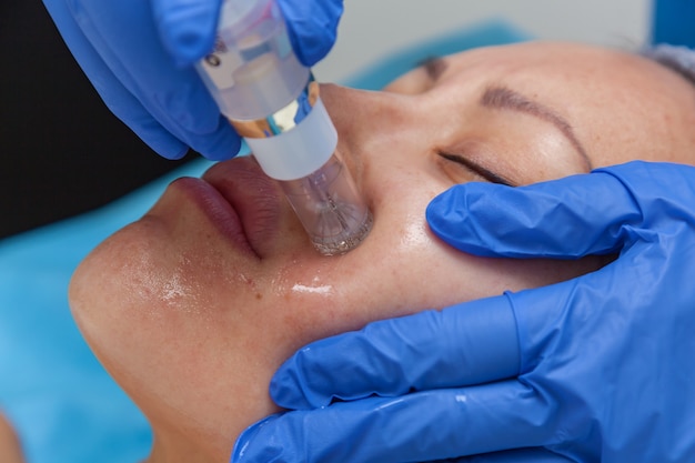 Cosmetic treatment by injection in the clinic. Use of a dermal injector to stimulate the skin. A woman receives injections of a placental-peptide serum