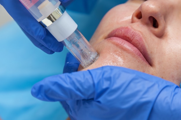 Cosmetische behandeling door injectie in de kliniek. Gebruik van een dermale injector om de huid te stimuleren. Een vrouw krijgt injecties met placenta-peptideserum