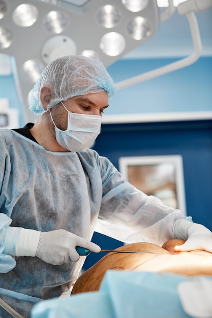 Cosmetische liposuctiechirurgie in de werkelijke operatiekameromgeving met chirurgengroep tijdens de operatie.