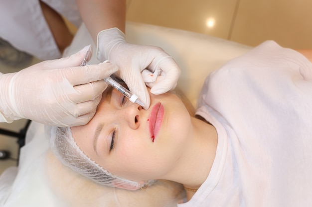 美容師は唇の上部にヒアルロン酸を注射し、それによってクライアントの唇のボリュームを増やします