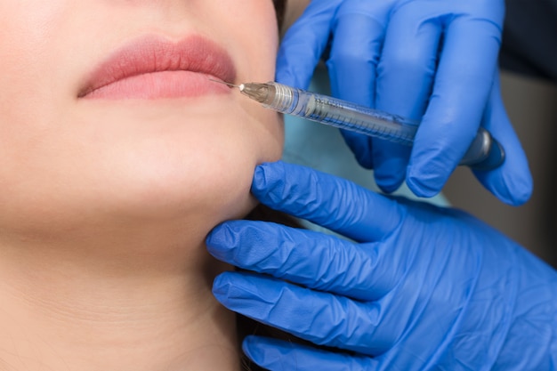 Cosmetologist makes lip augmentation procedure in a beauty salon. The beautician injects hyaluronic acid into the lips to increase the volume.