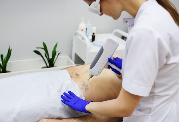 The cosmetologist removes the tattoo on the leg of a young pretty girl with a laser. Laser cosmetology