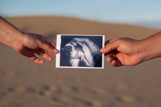 Couple hands holding ultrasound picture of their daughter.Pregnancy concept.