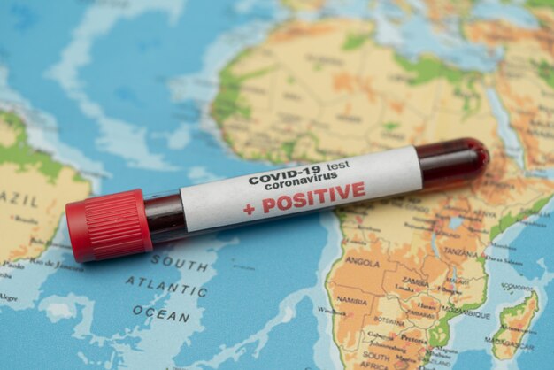 COVID 19 Coronavirus, infected blood sample in the sample tube, on world map, spread of disease, pandemic