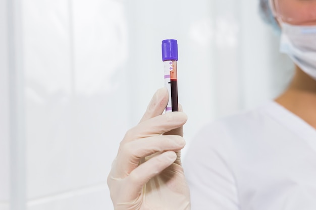 Covid-19, pandemic and viruses concept - hand holding blood in tests tubes close up, white background with copy space